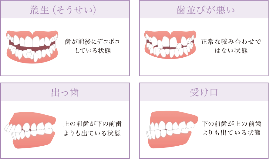 マウスピース型矯正に向いていない主な症状