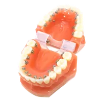 裏側矯正の模型