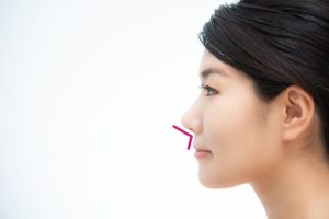 Eライン　横顔　条件