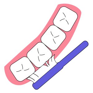 天神　矯正　歯磨き