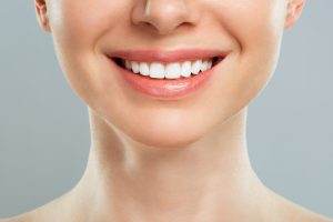 歯列矯正がたらこ唇改善に効く！？