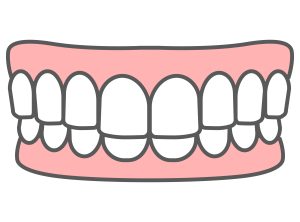 歯並びで上下の前歯が深すぎるときの矯正は？