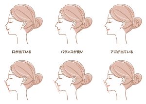 歯列矯正で顔が変わることはありますか？