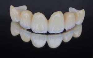 歯列矯正以外にもある？歯並びをキレイにする治療方法