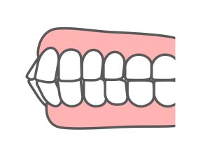 歯科　矯正歯科 歯並び