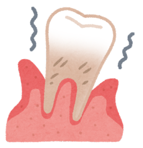歯科　矯正歯科 歯周病