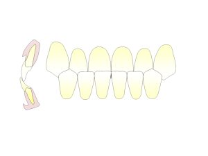 下顎前突　歯並び　原因