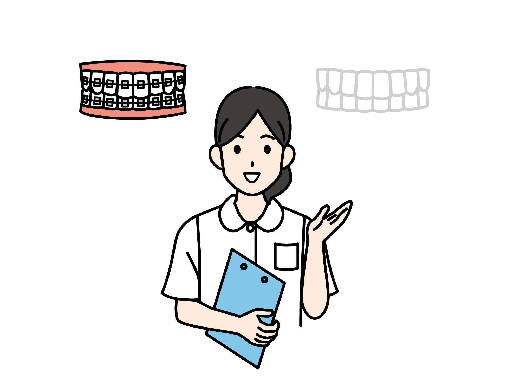 ワイヤー　マウスピース　矯正