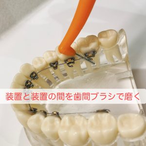 矯正　歯間ブラシ