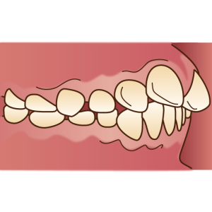 福岡　矯正　歯科