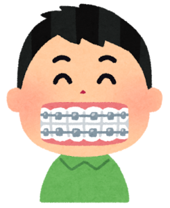 ホワイトニング 出来ない 避ける